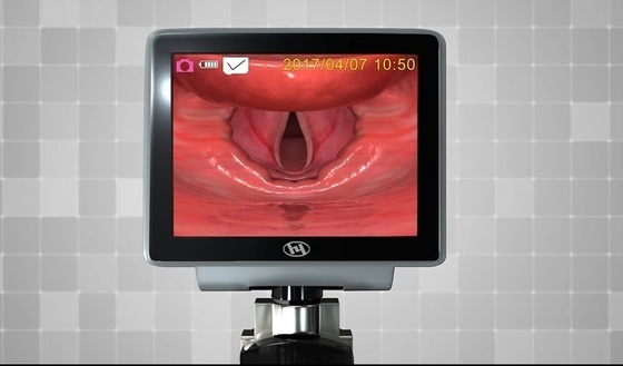 HYHJ 1320の金属の使い捨て可能な刃が付いているプラスチック繊維光学のビデオLaryngoscope