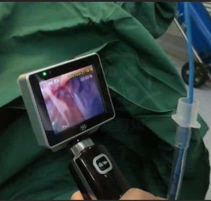 ICU EMSの1280 x 720台のカメラの決断の単一の使用挿管法のビデオLaryngoscope