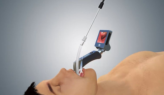 5マック・ミラーの刃の人間工学的手のすねが付いている医学のデジタル ビデオLaryngoscope
