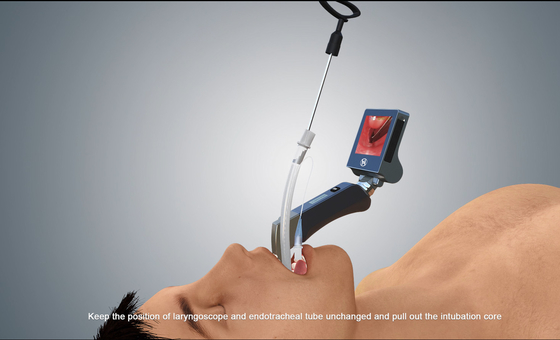 HYHJ-KCの防水医学の外科ビデオLaryngoscope LEDの光源