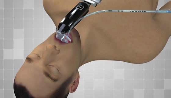 3.0インチ スクリーンの病院のEnt電子内視鏡の光学Laryngoscope Usbは出力した