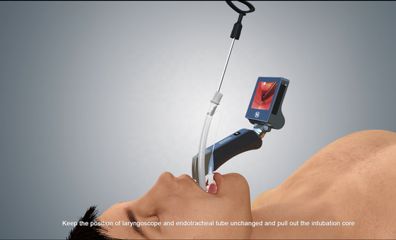再使用可能な刃の繊維光学McgrathのビデオLaryngoscope ISO13485