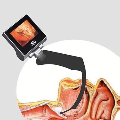 360度LCDの再使用可能な麻酔のビデオLaryngoscope 2，000,000のピクセル