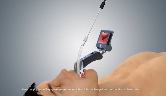 HYHJ-KCの医学等級の金属の物質的なデジタル反霧のカメラ システム ビデオLaryngoscope