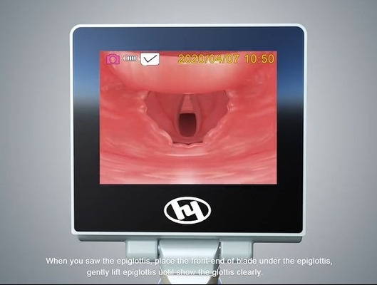 難しさの刃が付いている救急車のENT堅い麻酔のビデオLaryngoscope